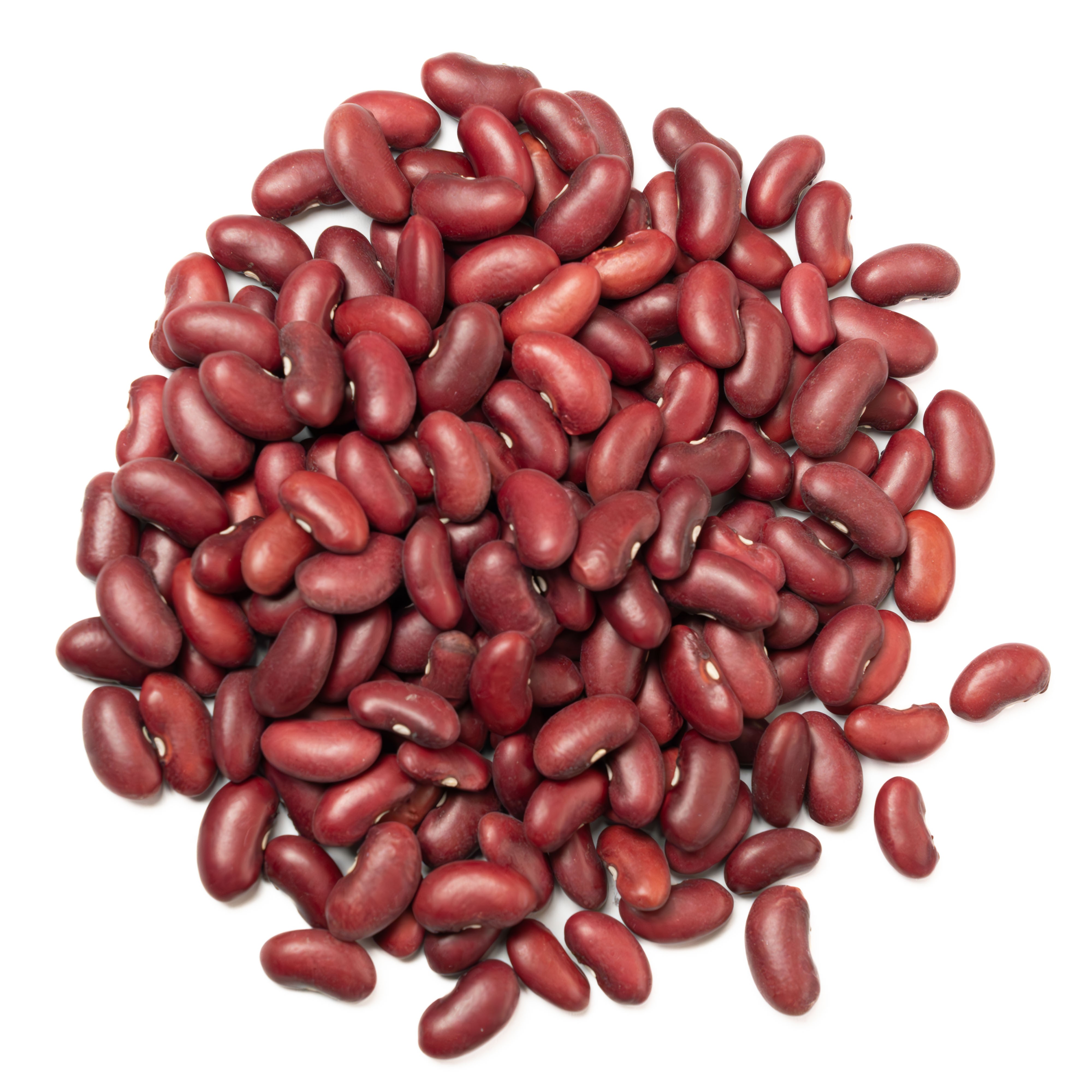 Red Kidney Bean Gojam (DAB-96)
